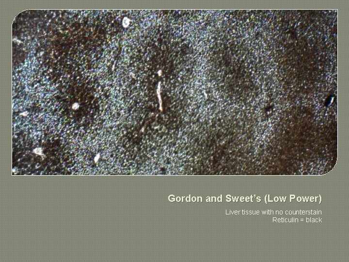 Gordon and Sweet’s (Low Power) Liver tissue with no counterstain Reticulin = black 