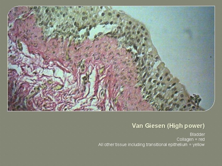 Van Giesen (High power) Bladder Collagen = red All other tissue including transitional epithelium