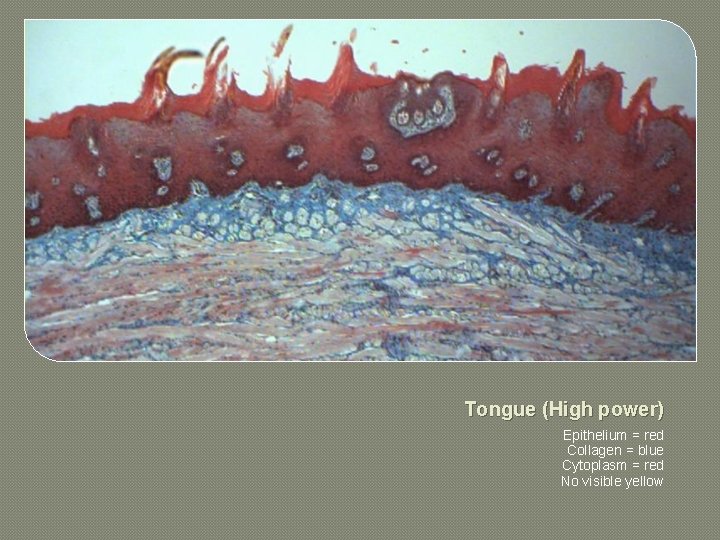 Tongue (High power) Epithelium = red Collagen = blue Cytoplasm = red No visible