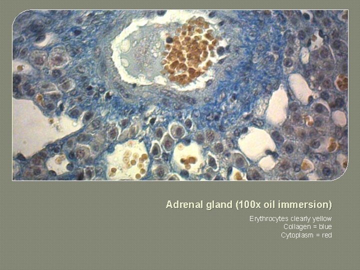 Adrenal gland (100 x oil immersion) Erythrocytes clearly yellow Collagen = blue Cytoplasm =
