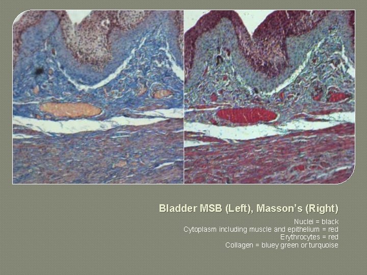  Bladder MSB (Left), Masson’s (Right) Nuclei = black Cytoplasm including muscle and epithelium