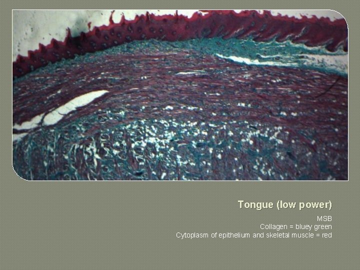Tongue (low power) MSB Collagen = bluey green Cytoplasm of epithelium and skeletal muscle