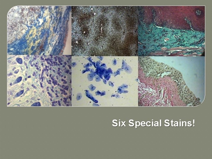 Six Special Stains! 