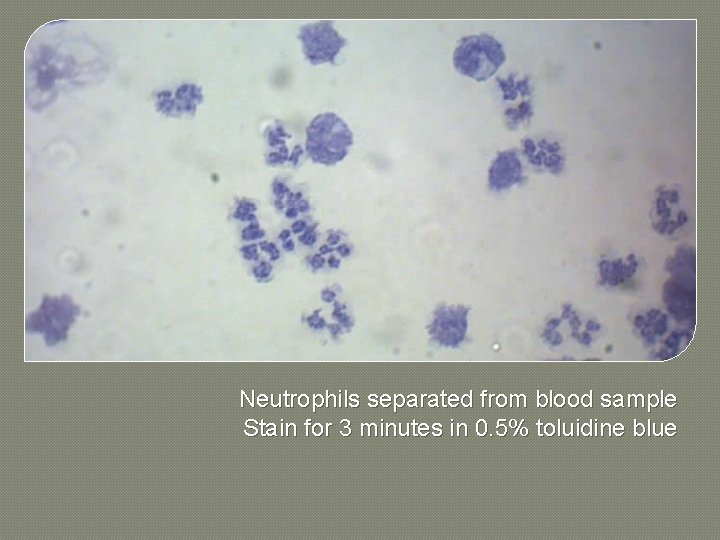 Neutrophils separated from blood sample Stain for 3 minutes in 0. 5% toluidine
