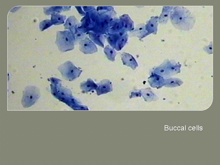Buccal cells 