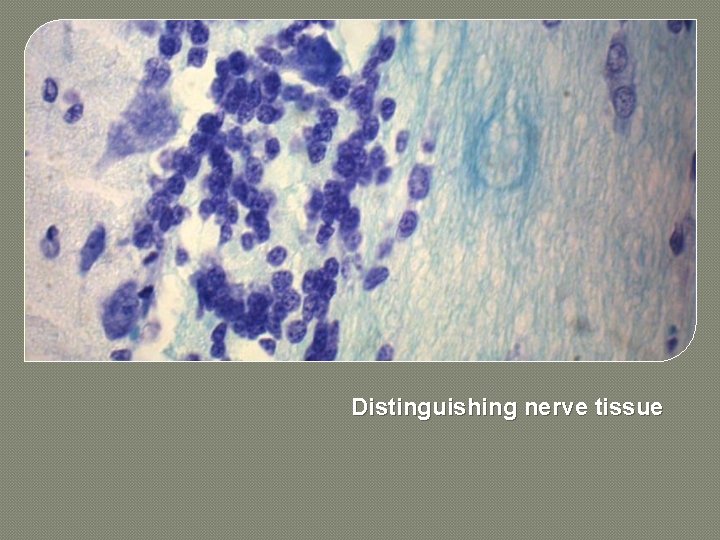 Distinguishing nerve tissue 