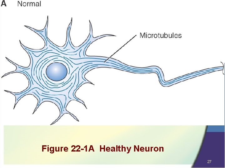 Figure 22 -1 A Healthy Neuron 27 