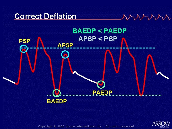 Correct Deflation PSP BAEDP < PAEDP APSP < PSP APSP PAEDP BAEDP 
