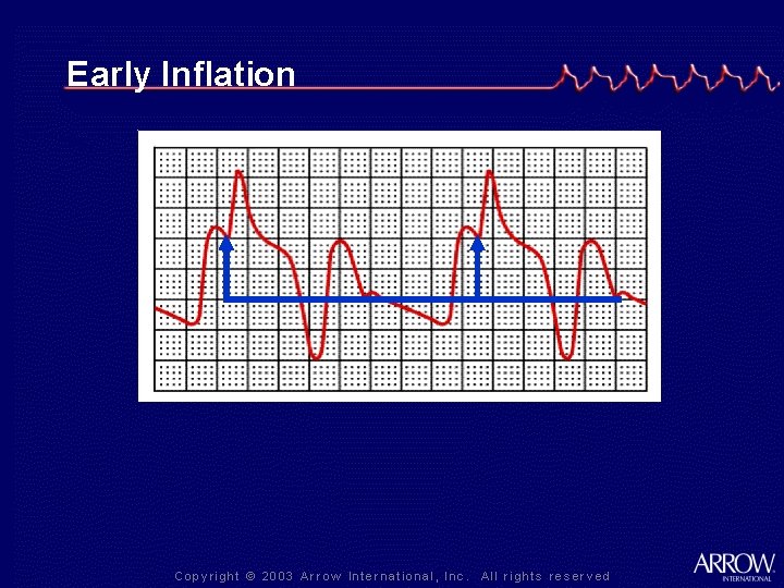 Early Inflation 