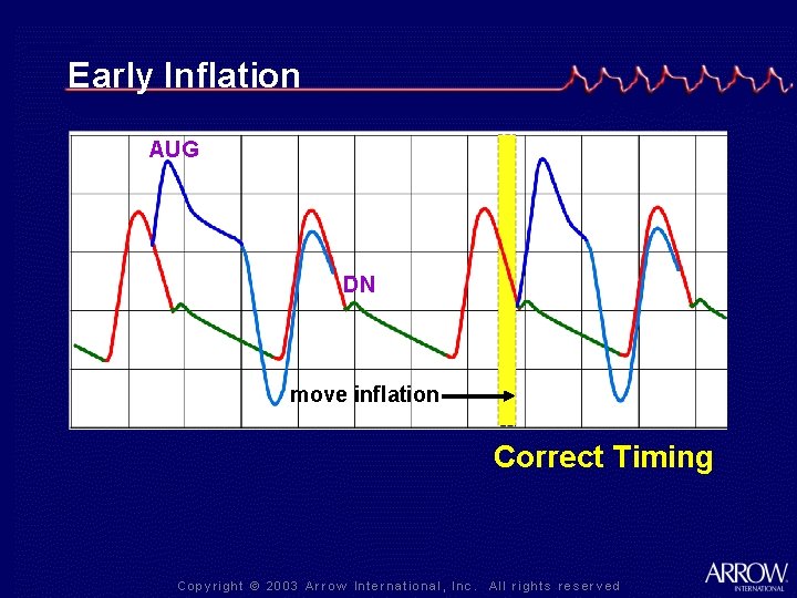Early Inflation AUG DN move inflation Correct Timing 