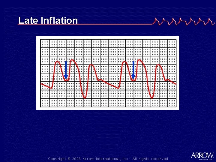 Late Inflation 