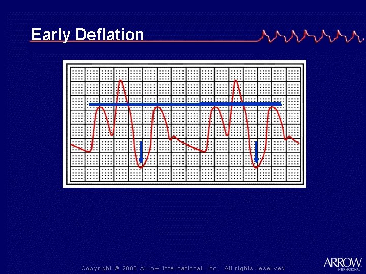Early Deflation 