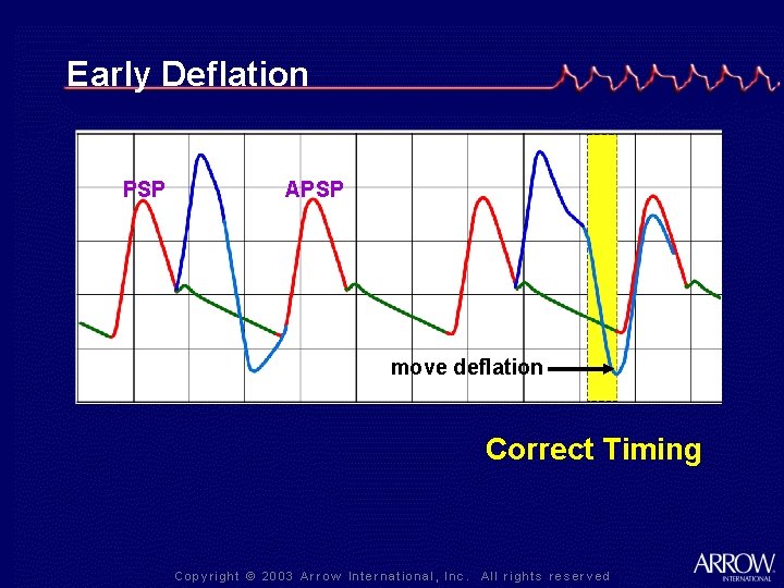 Early Deflation PSP APSP move deflation Correct Timing 