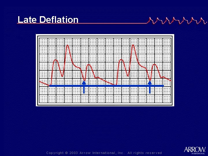 Late Deflation 
