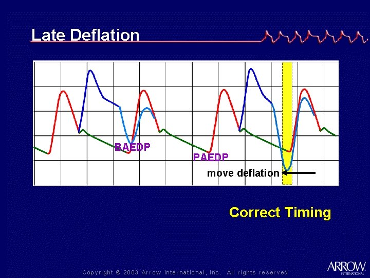 Late Deflation BAEDP PAEDP move deflation Correct Timing 