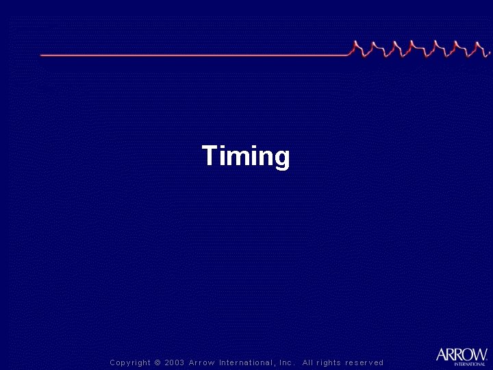 Timing 