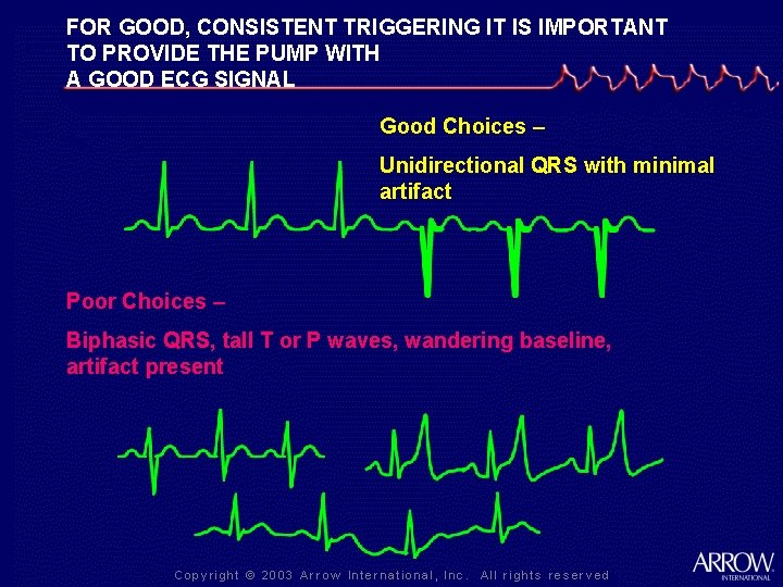 FOR GOOD, CONSISTENT TRIGGERING IT IS IMPORTANT TO PROVIDE THE PUMP WITH A GOOD