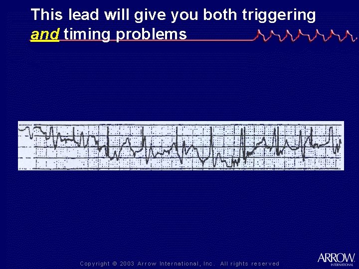 This lead will give you both triggering and timing problems 