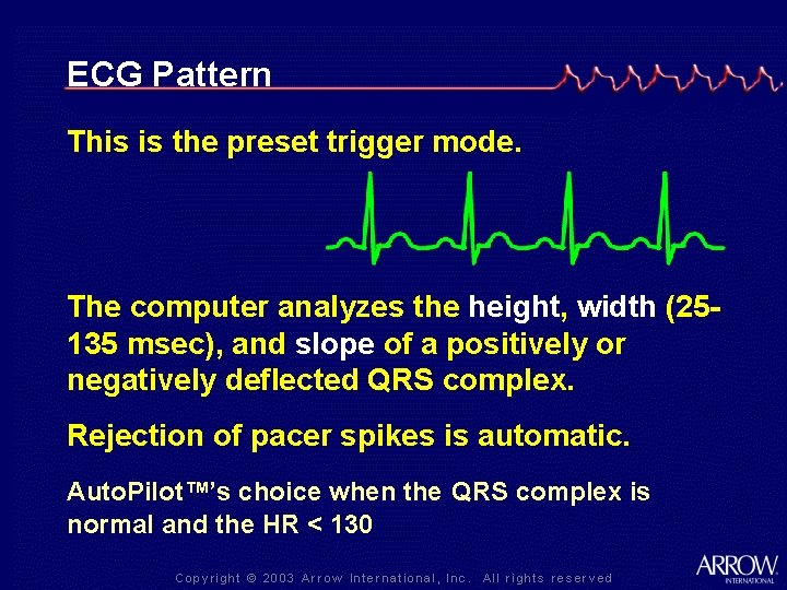 ECG Pattern This is the preset trigger mode. The computer analyzes the height, width