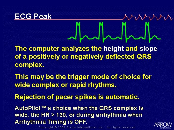 ECG Peak The computer analyzes the height and slope of a positively or negatively