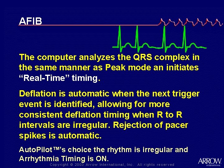 AFIB The computer analyzes the QRS complex in the same manner as Peak mode