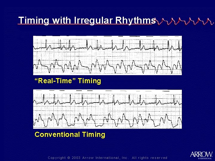 Timing with Irregular Rhythms “Real-Time” Timing Conventional Timing 