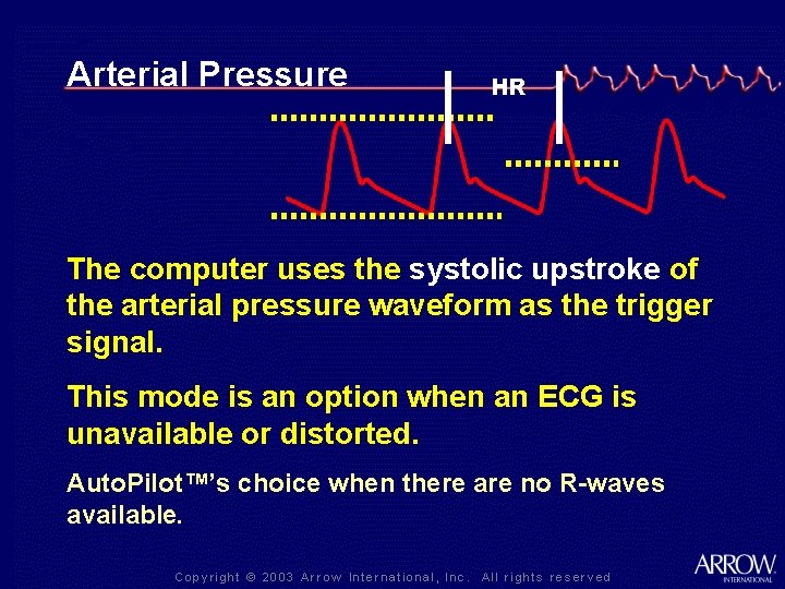 Arterial Pressure HR The computer uses the systolic upstroke of the arterial pressure waveform