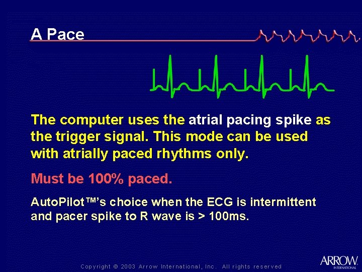 A Pace The computer uses the atrial pacing spike as the trigger signal. This