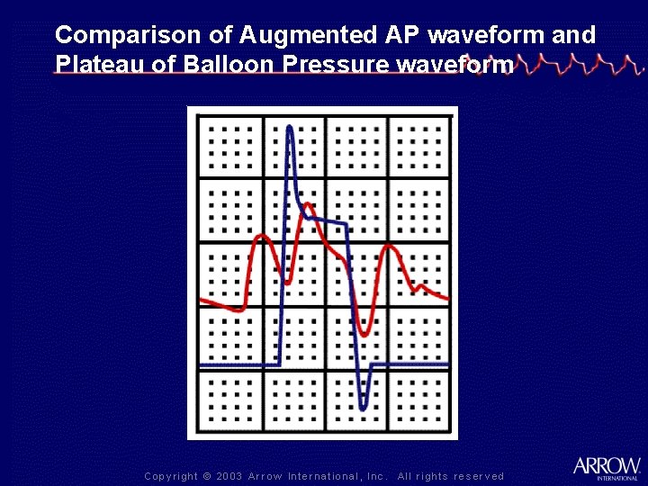 Comparison of Augmented AP waveform and Plateau of Balloon Pressure waveform 