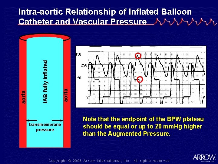 Intra-aortic Relationship of Inflated Balloon Catheter and Vascular Pressure transmembrane pressure 250 50 aorta