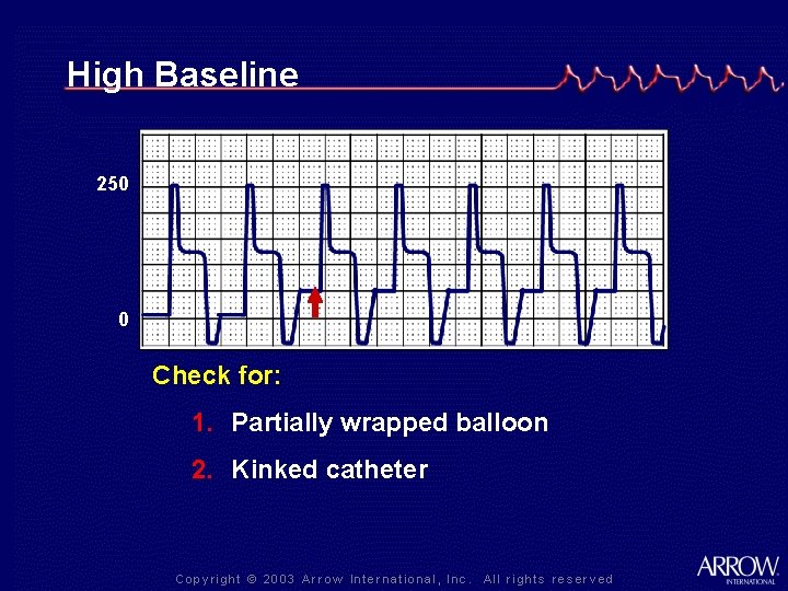 High Baseline 250 0 Check for: 1. Partially wrapped balloon 2. Kinked catheter 