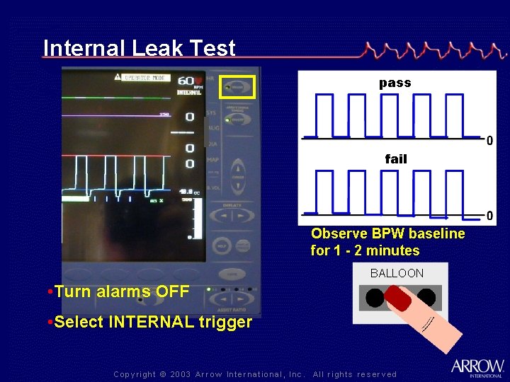 Internal Leak Test pass fail Observe BPW baseline for 1 - 2 minutes BALLOON