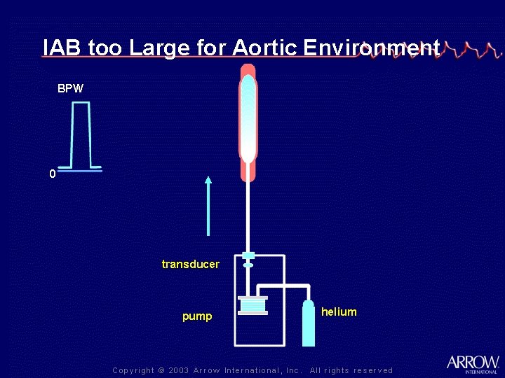 IAB too Large for Aortic Environment BPW 0 transducer pump helium 
