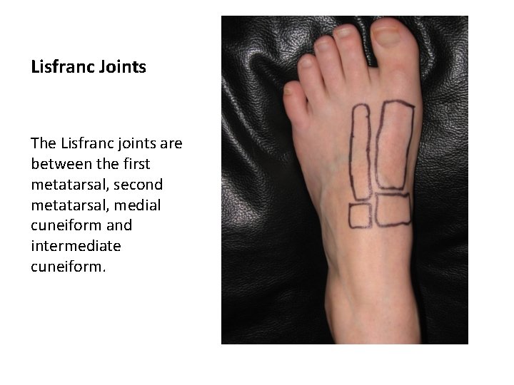 Lisfranc Joints The Lisfranc joints are between the first metatarsal, second metatarsal, medial cuneiform