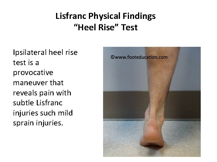 Lisfranc Physical Findings “Heel Rise” Test Ipsilateral heel rise test is a provocative maneuver
