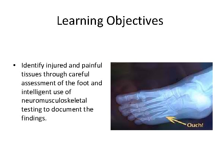 Learning Objectives • Identify injured and painful tissues through careful assessment of the foot