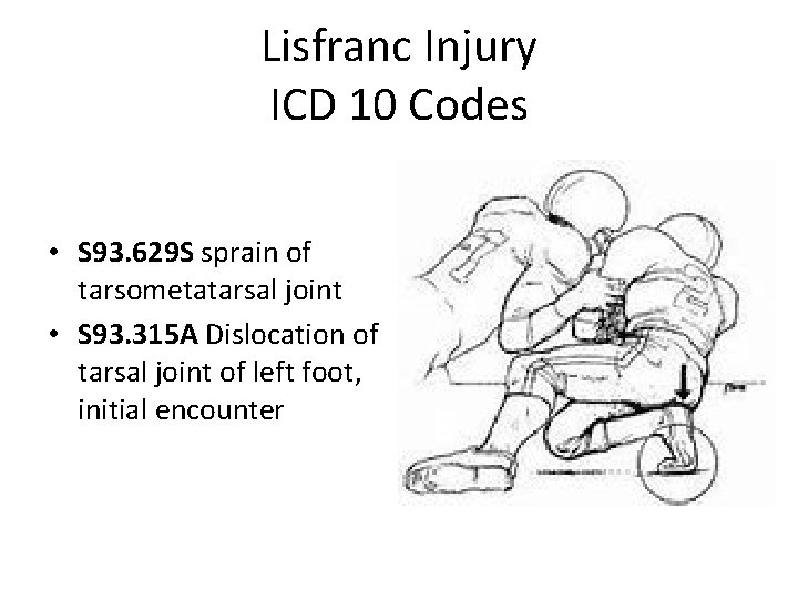 Lisfranc Injury ICD 10 Codes • S 93. 629 S sprain of tarsometatarsal joint
