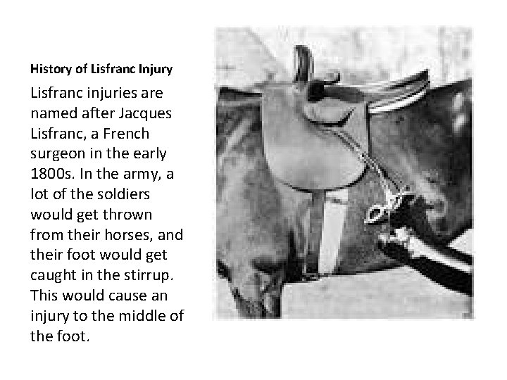 History of Lisfranc Injury Lisfranc injuries are named after Jacques Lisfranc, a French surgeon