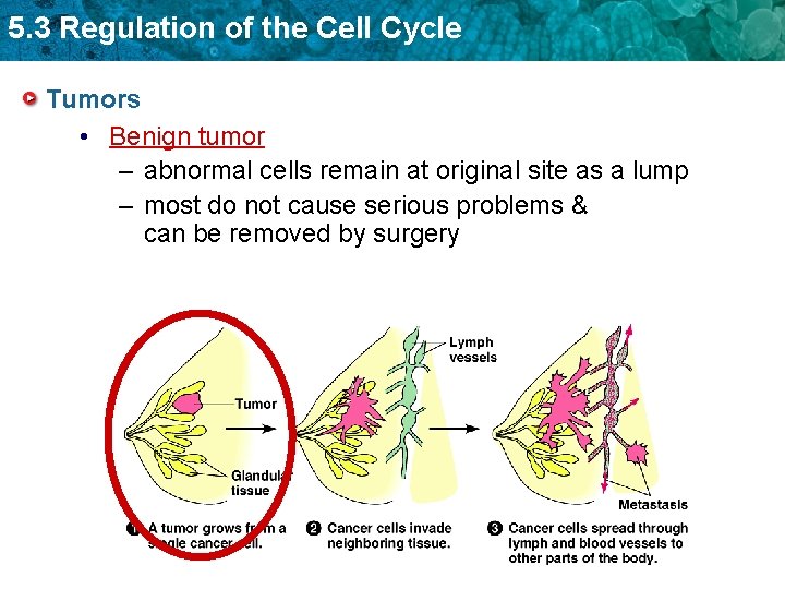 5. 3 Regulation of the Cell Cycle Tumors • Benign tumor – abnormal cells