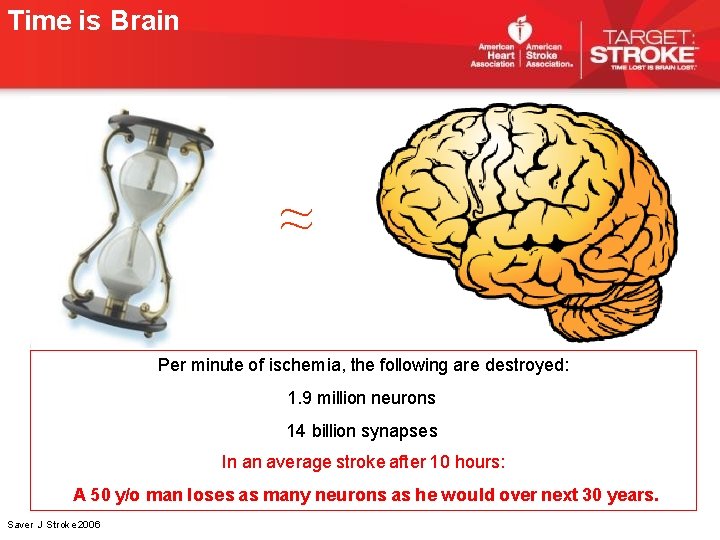 Time is Brain ≈ Per minute of ischemia, the following are destroyed: 1. 9 Time is Brain ≈ Per minute of ischemia, the following are destroyed: 1. 9