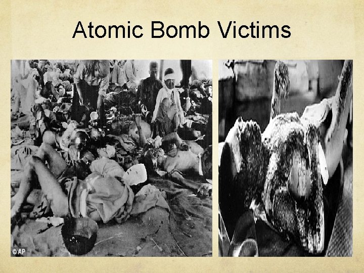 Atomic Bomb Victims 