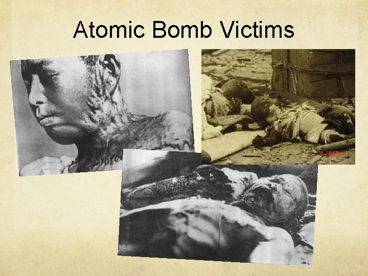 Atomic Bomb Victims 