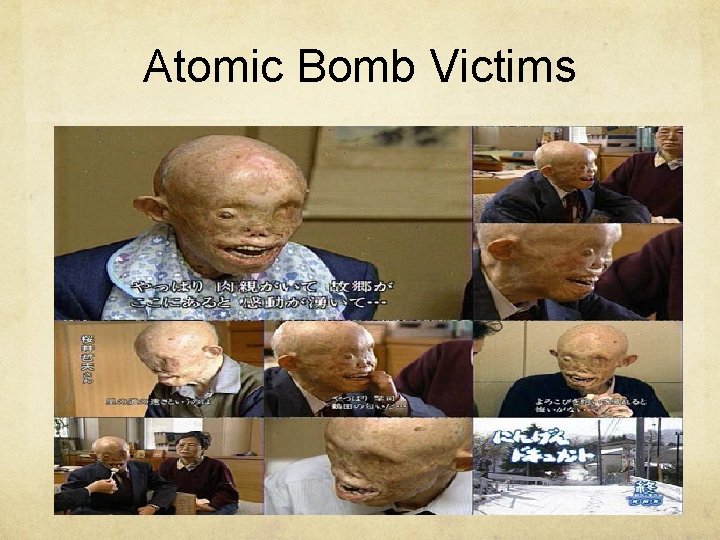 Atomic Bomb Victims 