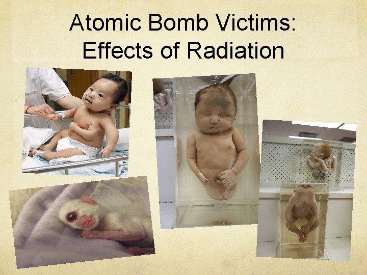 Atomic Bomb Victims: Effects of Radiation 