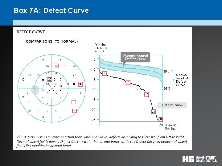 Box 7 A: Defect Curve 