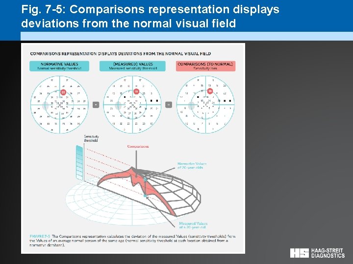 Fig. 7 -5: Comparisons representation displays deviations from the normal visual field 