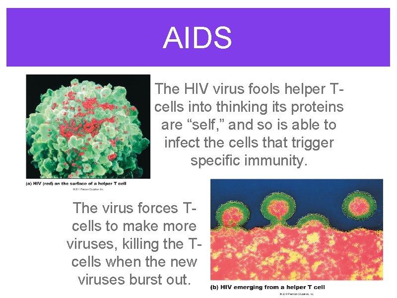 AIDS The HIV virus fools helper Tcells into thinking its proteins are “self, ”