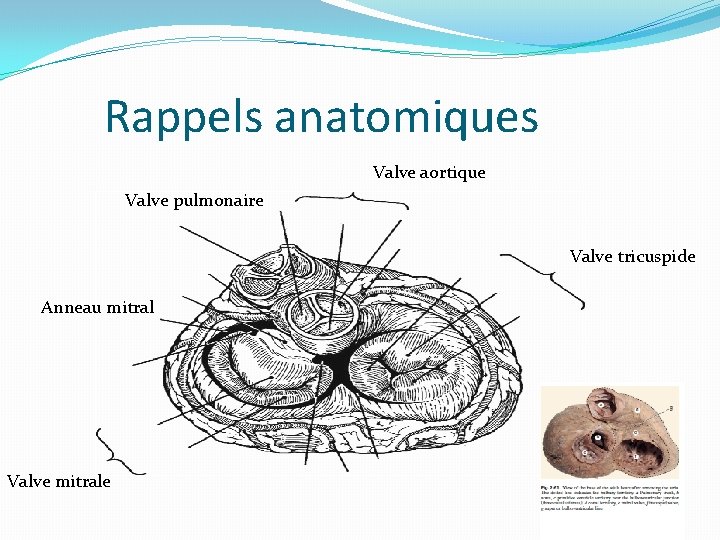 Rappels anatomiques Valve aortique Valve pulmonaire Valve tricuspide Anneau mitral Valve mitrale 