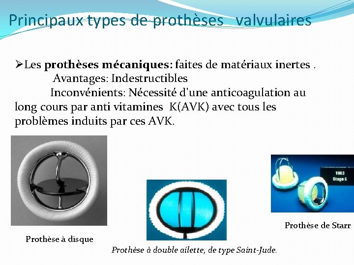 Principaux types de prothèses valvulaires ØLes prothèses mécaniques: faites de matériaux inertes. Avantages: Indestructibles