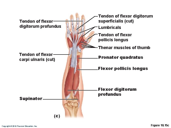 Tendon of flexor digitorum profundus Tendon of flexor digitorum superficialis (cut) Lumbricals Tendon of Tendon of flexor digitorum profundus Tendon of flexor digitorum superficialis (cut) Lumbricals Tendon of